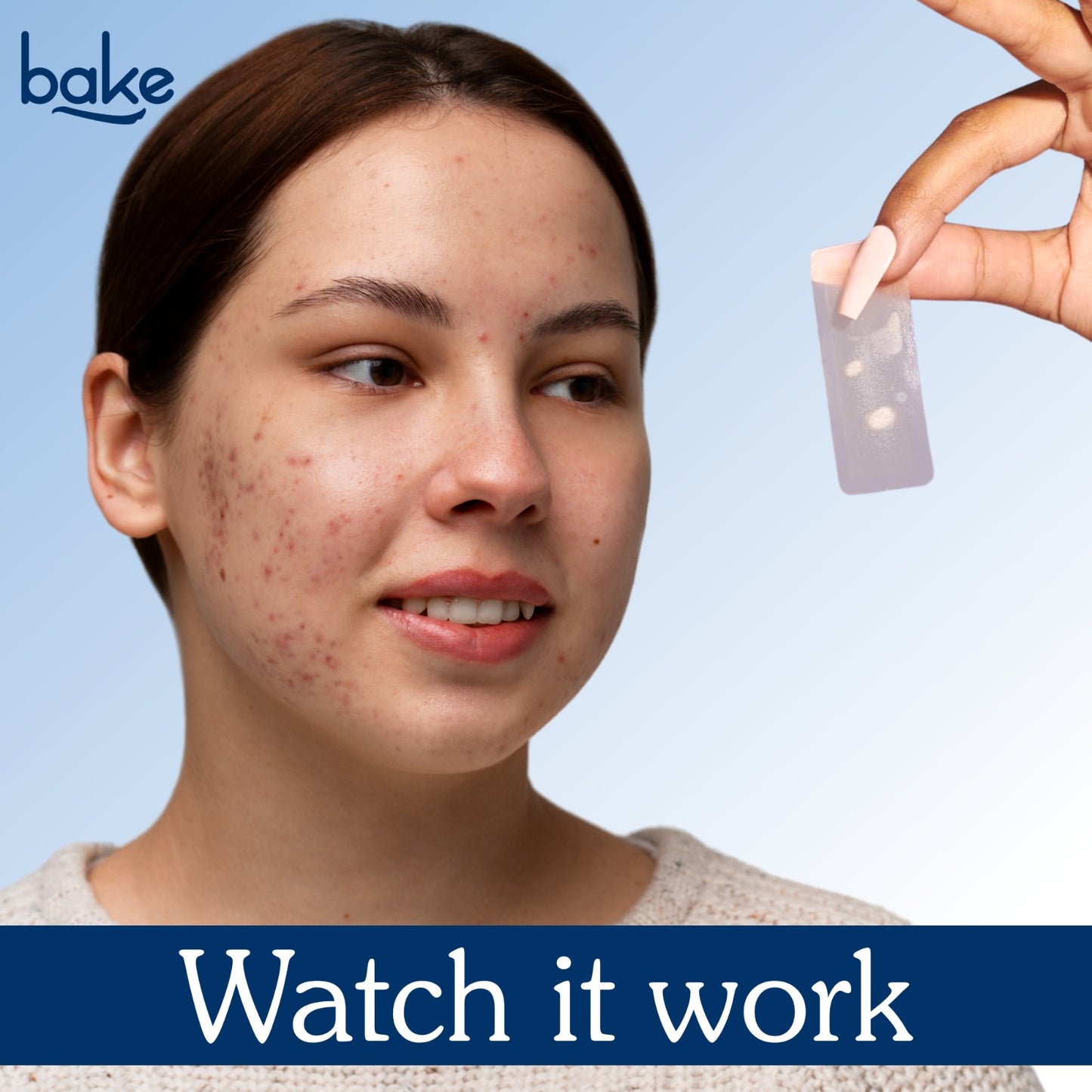 Acne Erase XL Pimple Patches - 10 Strips